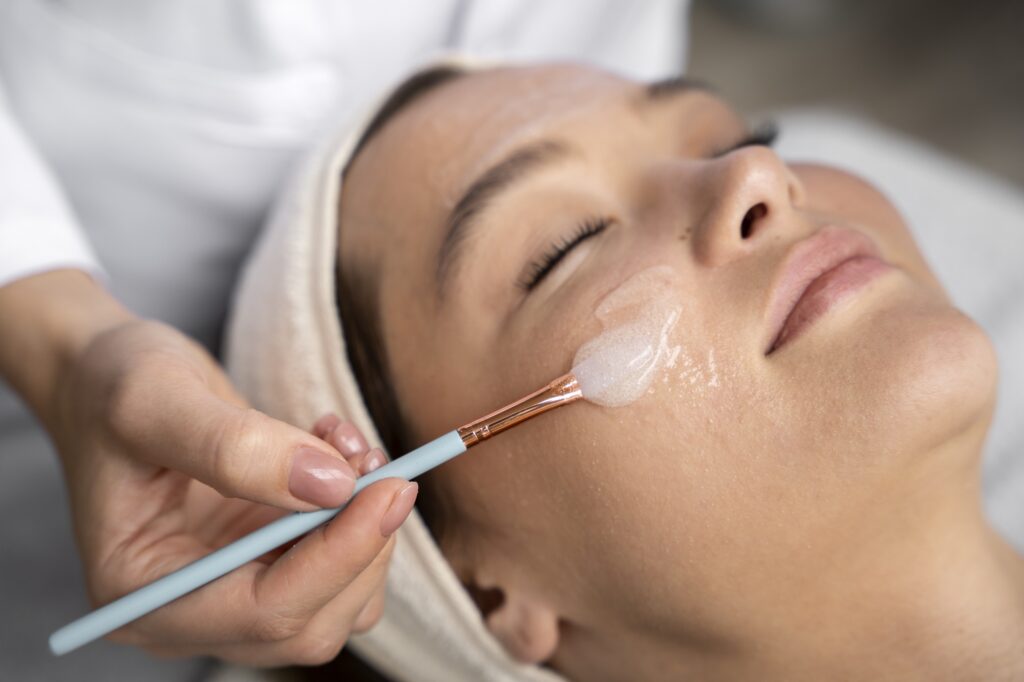 chemical peel